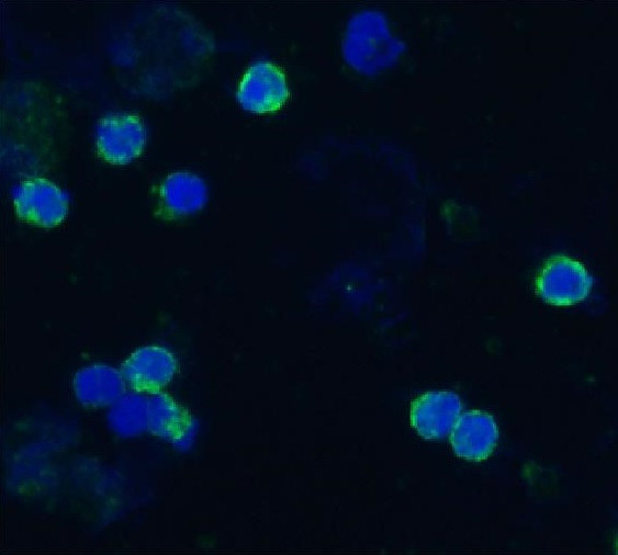 Anti-CD18, clone IVA35