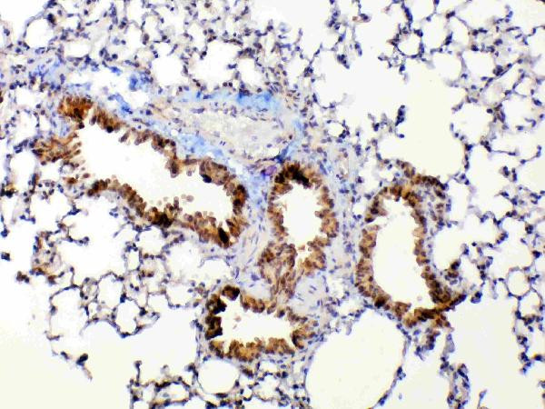 Anti-MMP13