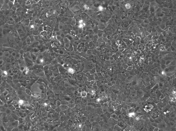 Colo-680N Cells