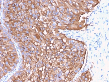 Anti-Uroplakin 1A / UPK1A, clone UPK1A/2922