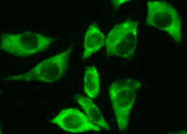 Anti-IL10R subunit beta