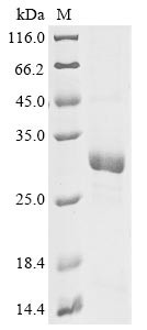 Virulence plasmid protein pGP3-D, Chlamydia trachomatis, recombinant