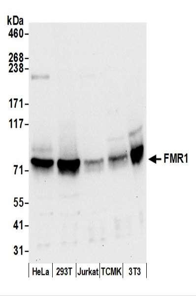 Anti-FMR1/FMRP