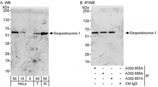 Anti-Sequestosome-1