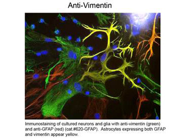 Anti-Vimentin