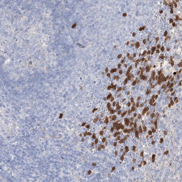 Anti-NIPAL4