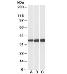 Anti-Lactate Dehydrogenase B