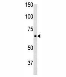 Anti-Glial fibrillary acidic protein