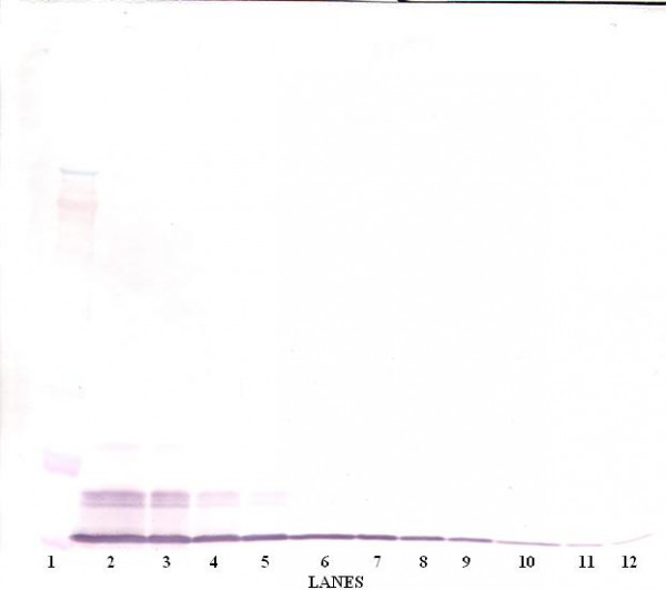 Anti-CCL4 / MCP1 beta