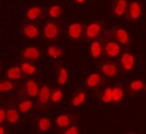 Anti-FEN1, clone 7H8-F4-C11