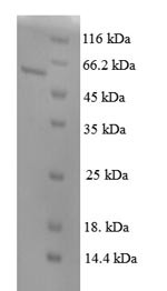 Pituitary homeobox 3 (Pitx3), mouse, recombinant