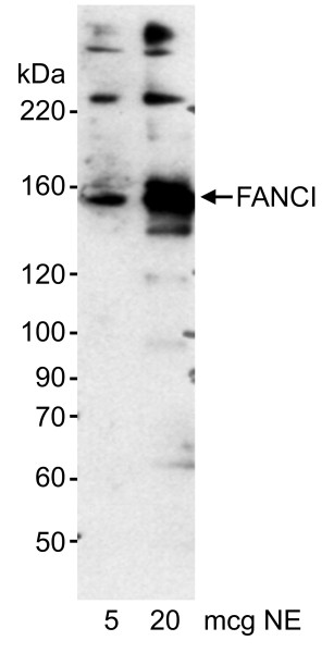 Anti-FANCI