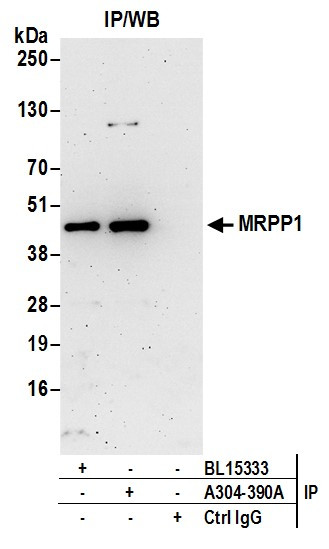 Anti-MRPP1
