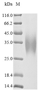 Carbamoyl-phosphate synthase [ammonia], mitochondrial (CPS1),partial, human, recombinant