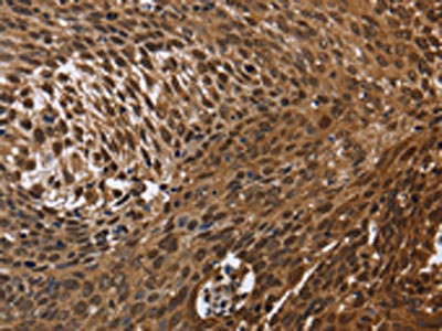 Anti-DCP1A
