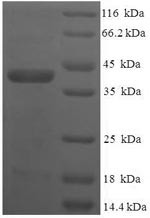 Vesicle transport through interaction with t-SNAREs homolog 1B (VTI1B), partial, human, recombinant