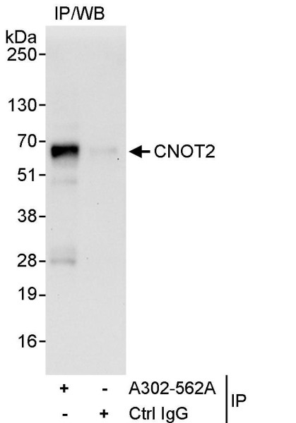 Anti-CNOT2