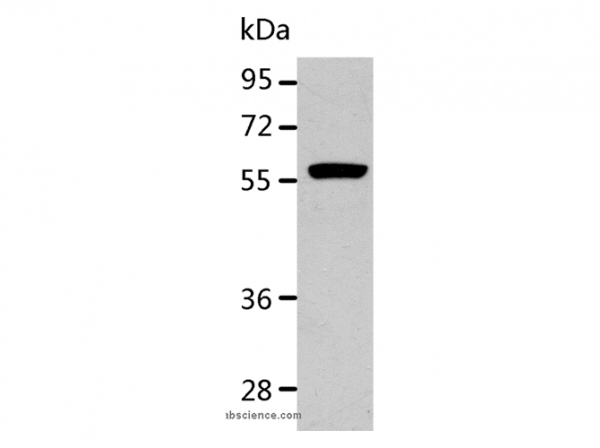 Anti-ALDH1A2