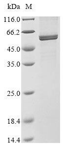 Nucleoprotein (N), human coronavirus 229E, recombinant