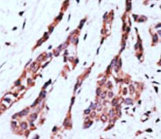 Anti-LPAR2 / EDG4