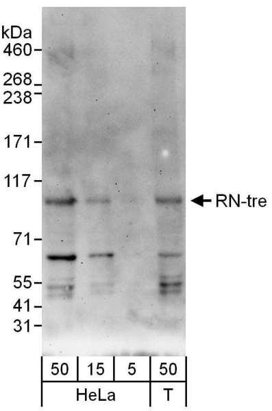 Anti-RN-tre