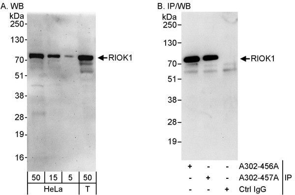 Anti-RIOK1