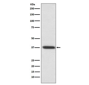 Anti-Rhodopsin, clone AADI-18