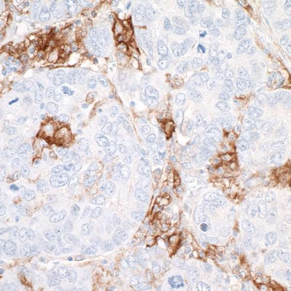 Anti-CD40 Recombinant Monoclonal