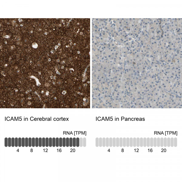 Anti-ICAM5