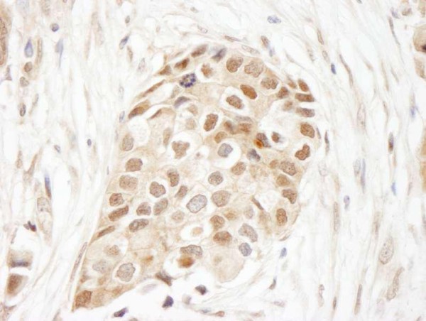 Anti-Ubiquitin (IHC)