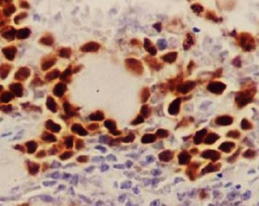 Anti-phospho-Rb1 / Retinoblastoma protein (Ser807)