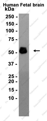 Anti-Recombinant Phospho-Tau (Thr181), clone C333030