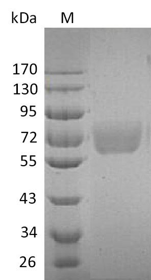 Interleukin-4 receptor subunit alpha (IL4R), partial (Active), human, recombinant