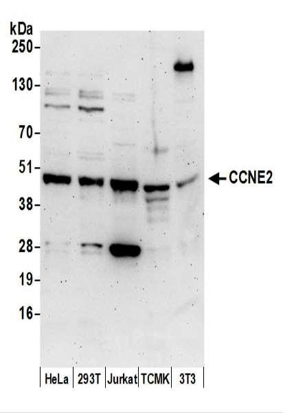 Anti-CCNE2/Cyclin E2