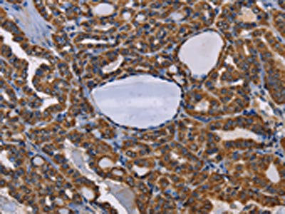 Anti-ADRBK2