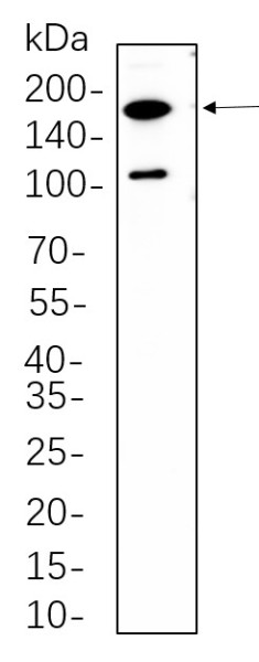 Anti-Recombinant Rictor, clone 11D8
