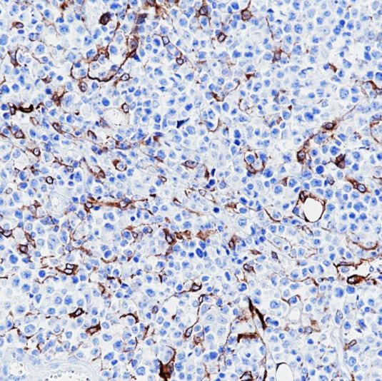 Anti-Podoplanin, clone SQab19158