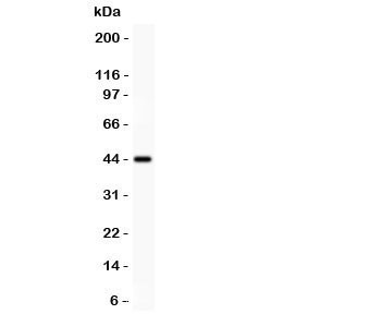 Anti-Mesothelin