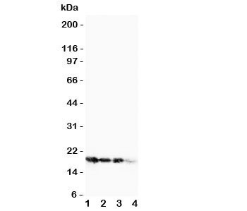 Anti-FGF1