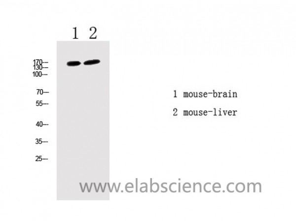 Anti-Phospho-LATS1/2 (Thr1079/1041)