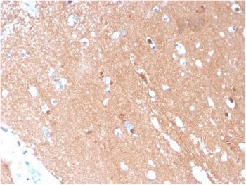 Anti-Tubulin beta 3 / TUBB3 (Neuronal &amp; Stem Cell Marker) Monoclona Antibody (Clone: TUBB3/3731)