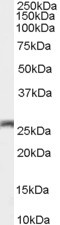 Anti-GJB2 / Connexin 26, C-terminal