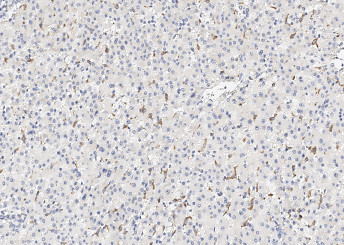 Anti-CD163 Monoclonal Antibody