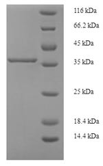 Phosphatidylinositol-glycan biosynthesis class X protein (PIGX), partial, human, recombinant