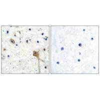 Anti-PTPN11