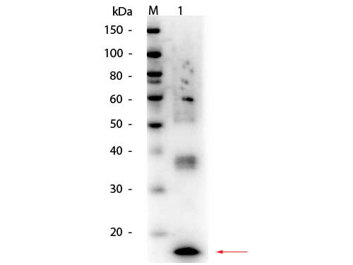 Anti-Tumor Necrosis Factor alpha (TNFa)