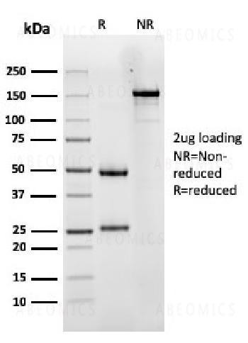 Anti-Luteinizing Hormone / Choriogonadotropin Receptor (LHCGR) Monoclonal Antibody (Clone: LHCGR/141