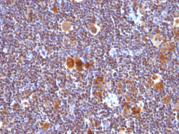 Anti-Bax (Apoptosis Marker), clone SPM336
