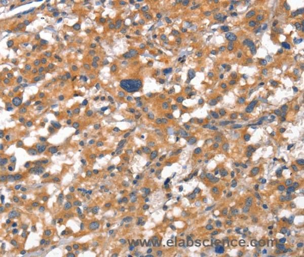 Anti-CDH5