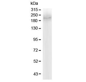 Anti-MRP2 / ABCC2